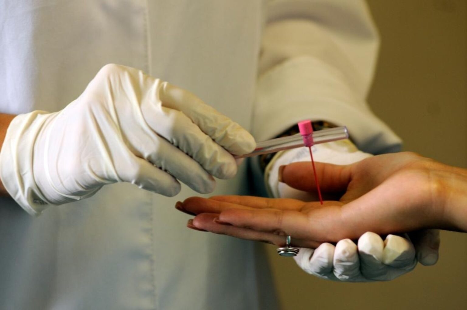 Ações Intensificadas para Combater a Hanseníase em Mato Grosso