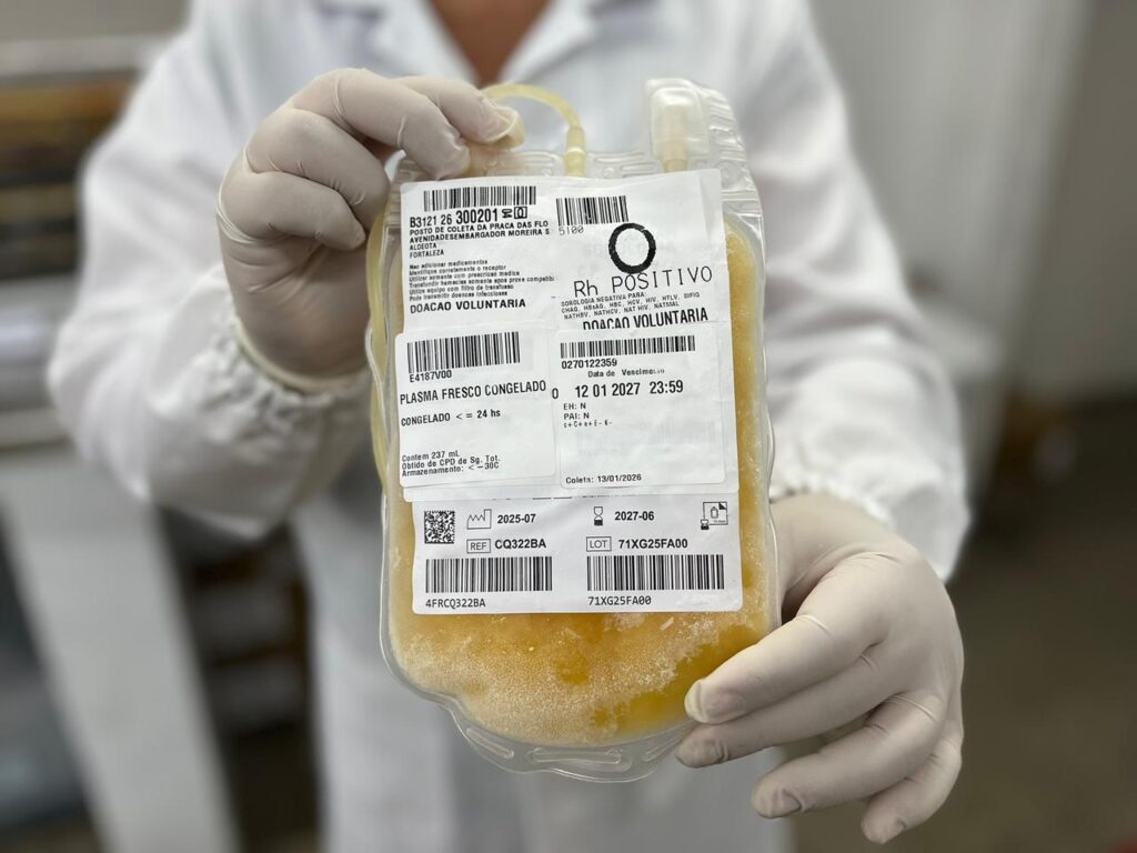 Hemoce Alcança 200 Mil Litros de Plasma: Avanços na Saúde Pública do Ceará