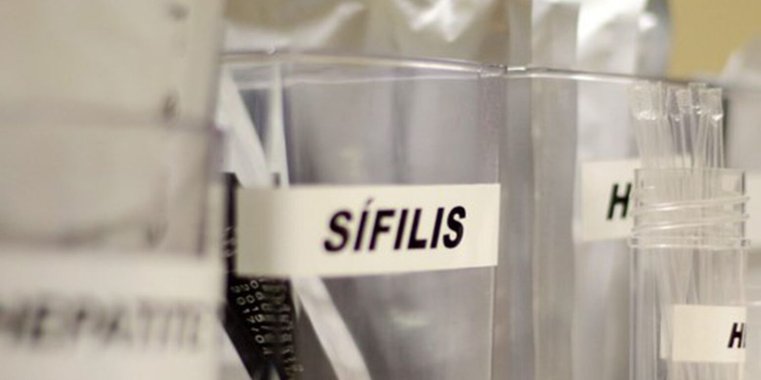 Testes Grátis de HIV e ISTs na Praça Roosevelt: Saúde na Mão de Todos Testes Grátis de HIV e ISTs na Praça Roosevelt: Saúde na Mão de Todos